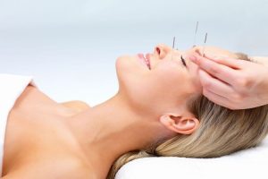  acupuncture mythe ou realite